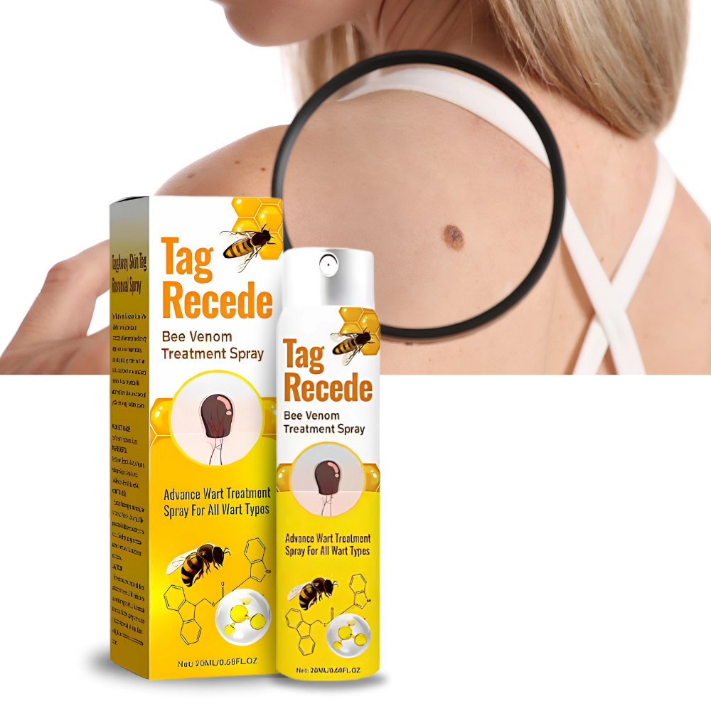 Non-Invasive Tag Recede - Ozerty